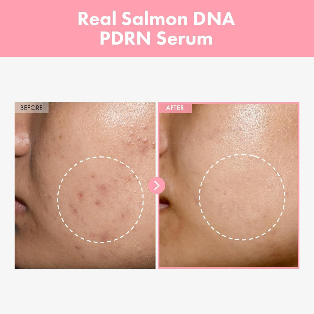 TOSOWOONG Pink Peptide 12 PDRN Serum With Salmon DNA PDRN 10,320ppm, 12 Peptides, Niacinamide, Skin glow, Hydrating, Moisturizing, Firming, Uneven Skin Tone, Korean Skincare, 33ml, 1.11 fl.oz.